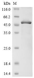 (Tris-Glycine gel) Discontinuous SDS-PAGE (reduced) with 5% enrichment gel and 15% separation gel.