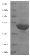 Recombinant Human Transcription intermediary factor 1-alpha (TRIM24), partial – Figure 1 of 1
