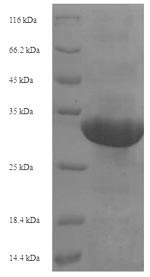 Recombinant Human Transcription intermediary factor 1-alpha (TRIM24), partial – Figure 1 of 1