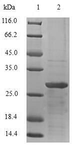 Recombinant Human Thyrotropin subunit beta (TSHB) – Figure 1 of 1