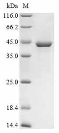 (Tris-Glycine gel) Discontinuous SDS-PAGE (reduced) with 5% enrichment gel and 15% separation gel.