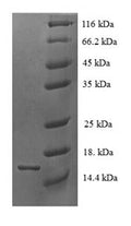 Recombinant Human Tetraspanin-7 (TSPAN7), partial – Figure 1 of 1