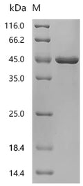 (Tris-Glycine gel) Discontinuous SDS-PAGE (reduced) with 5% enrichment gel and 15% separation gel.