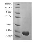 Recombinant Human Transthyretin (TTR) – Figure 1 of 1