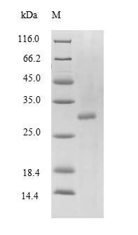 (Tris-Glycine gel) Discontinuous SDS-PAGE (reduced) with 5% enrichment gel and 15% separation gel.