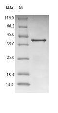(Tris-Glycine gel) Discontinuous SDS-PAGE (reduced) with 5% enrichment gel and 15% separation gel.