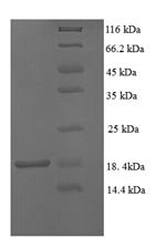 Recombinant Macaca fascicularis Transthyretin (TTR) – Figure 1 of 1