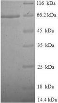 Recombinant Human Tubulin beta-2A chain (TUBB2A) – Figure 1 of 1