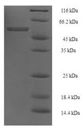Recombinant Acinetobacter baumannii Elongation factor Tu (tuf1) – Figure 1 of 1