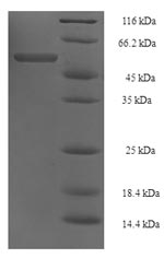 Recombinant Acinetobacter baumannii Elongation factor Tu (tuf1) – Figure 1 of 1