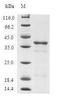 (Tris-Glycine gel) Discontinuous SDS-PAGE (reduced) with 5% enrichment gel and 15% separation gel.