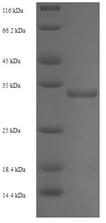 Recombinant Human Thioredoxin domain-containing protein 12 (TXNDC12) – Figure 1 of 1