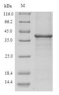 Recombinant Human Thioredoxin domain-containing protein 17 (TXNDC17) – Figure 1 of 1