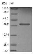 Recombinant Human Thioredoxin-like protein 1 (TXNL1) – Figure 1 of 1