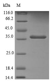 Recombinant Human Thioredoxin-like protein 1 (TXNL1) – Figure 1 of 1
