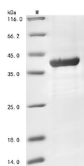 (Tris-Glycine gel) Discontinuous SDS-PAGE (reduced) with 5% enrichment gel and 15% separation gel.