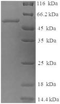 Recombinant Human Tyrosinase (TYR), partial – Figure 1 of 1