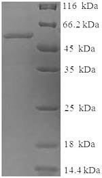 Recombinant Human Tyrosinase (TYR), partial – Figure 1 of 1