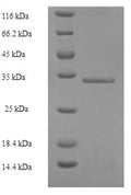 Recombinant Human Ubiquitin D (UBD) – Figure 1 of 1