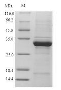 Recombinant Human Ubiquitin-conjugating enzyme E2 D3 (UBE2D3) – Figure 1 of 1