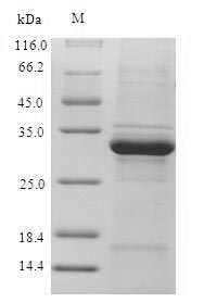 Recombinant Human Ubiquitin-conjugating enzyme E2 D3 (UBE2D3) – Figure 1 of 1