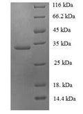 Recombinant Human Ubiquitin-conjugating enzyme E2 variant 2 (UBE2V2) – Figure 1 of 1
