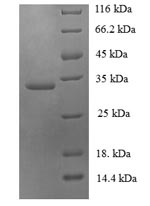 Recombinant Human Ubiquitin-conjugating enzyme E2 variant 2 (UBE2V2) – Figure 1 of 1