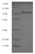 Recombinant Human Ubiquitin carboxyl-terminal hydrolase isozyme L5 (UCHL5) – Figure 1 of 1