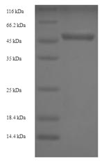 Recombinant Human Ubiquitin carboxyl-terminal hydrolase isozyme L5 (UCHL5) – Figure 1 of 1