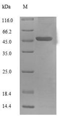 Recombinant Human Mitochondrial brown fat uncoupling protein 1 (UCP1) – Figure 1 of 1