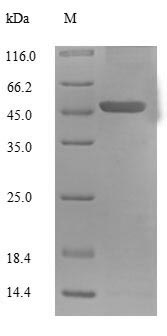 Recombinant Human Mitochondrial brown fat uncoupling protein 1 (UCP1) – Figure 1 of 1
