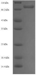 Recombinant Human UDP-glucose 6-dehydrogenase (UGDH) – Figure 1 of 1