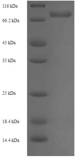 Recombinant Human UDP-glucose 6-dehydrogenase (UGDH) – Figure 1 of 1