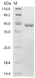 (Tris-Glycine gel) Discontinuous SDS-PAGE (reduced) with 5% enrichment gel and 15% separation gel.