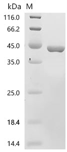 (Tris-Glycine gel) Discontinuous SDS-PAGE (reduced) with 5% enrichment gel and 15% separation gel.