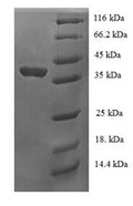 Recombinant Human Upstream stimulatory factor 1 (USF1), partial – Figure 1 of 1