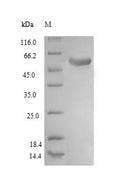 Recombinant Human Ubiquitin carboxyl-terminal hydrolase 14 (USP14) – Figure 1 of 1