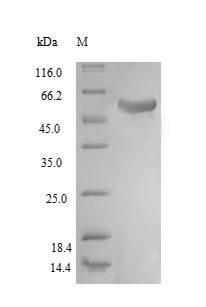 Recombinant Human Ubiquitin carboxyl-terminal hydrolase 14 (USP14) – Figure 1 of 1