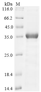 (Tris-Glycine gel) Discontinuous SDS-PAGE (reduced) with 5% enrichment gel and 15% separation gel.