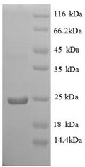 Recombinant Chicken Vesicle-associated membrane protein 7 (VAMP7), partial – Figure 1 of 1