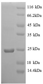Recombinant Chicken Vesicle-associated membrane protein 7 (VAMP7), partial – Figure 1 of 1