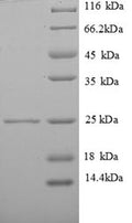 Recombinant Human Vesicle-associated membrane protein 7 (VAMP7), partial – Figure 1 of 1