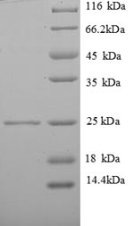 Recombinant Human Vesicle-associated membrane protein 7 (VAMP7), partial – Figure 1 of 1