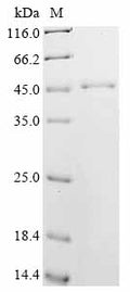 (Tris-Glycine gel) Discontinuous SDS-PAGE (reduced) with 5% enrichment gel and 15% separation gel.
