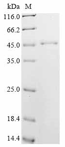 (Tris-Glycine gel) Discontinuous SDS-PAGE (reduced) with 5% enrichment gel and 15% separation gel.