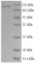 Recombinant Human Vascular cell adhesion protein 1 (VCAM1), partial – Figure 1 of 1