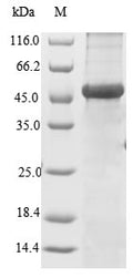 (Tris-Glycine gel) Discontinuous SDS-PAGE (reduced) with 5% enrichment gel and 15% separation gel.