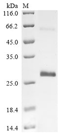 (Tris-Glycine gel) Discontinuous SDS-PAGE (reduced) with 5% enrichment gel and 15% separation gel.