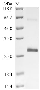 (Tris-Glycine gel) Discontinuous SDS-PAGE (reduced) with 5% enrichment gel and 15% separation gel.