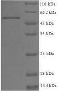 Recombinant Human WD repeat-containing protein 5 (WDR5) – Figure 1 of 1